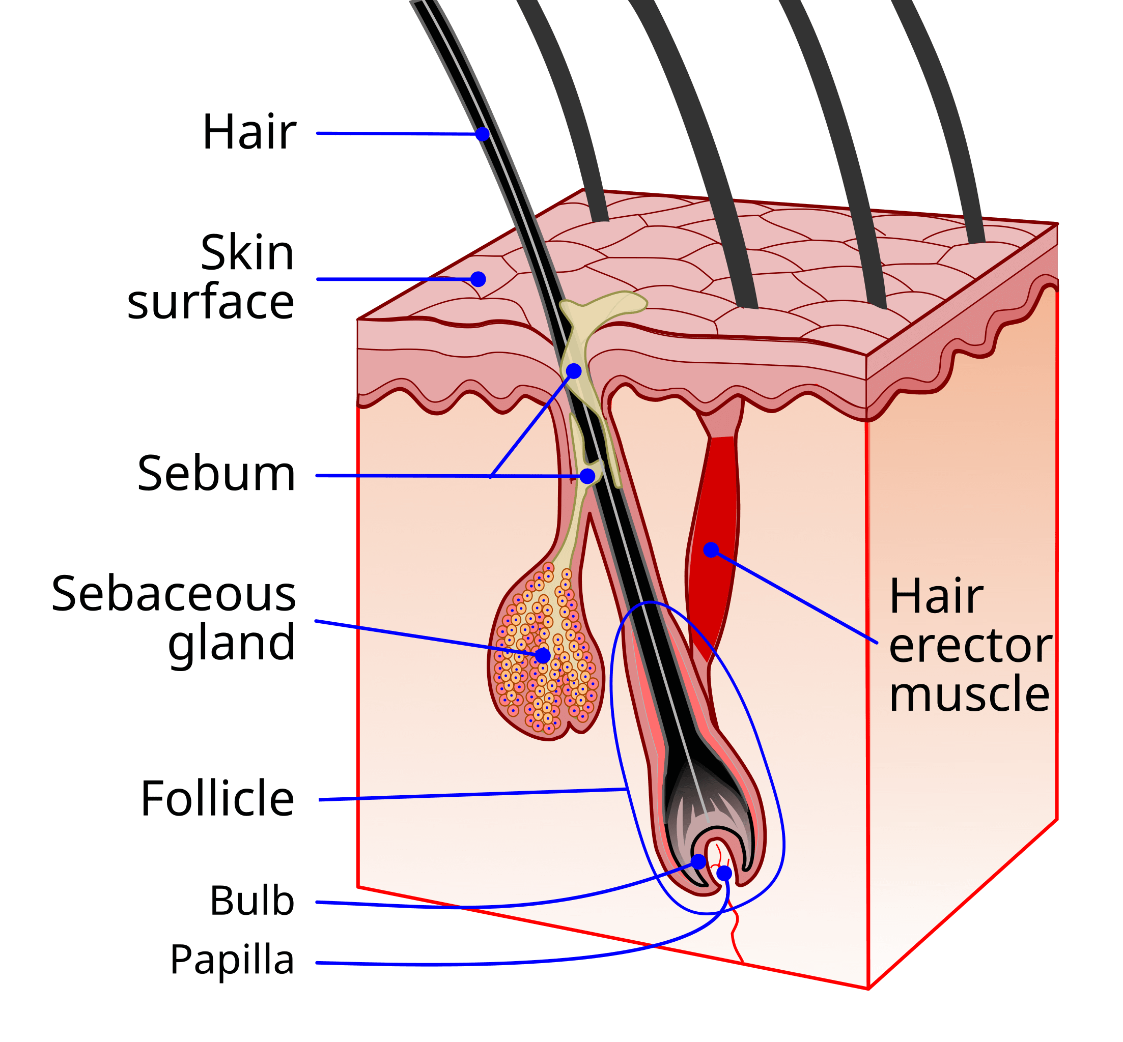 PCOS Acne Hair Follicle Diagram